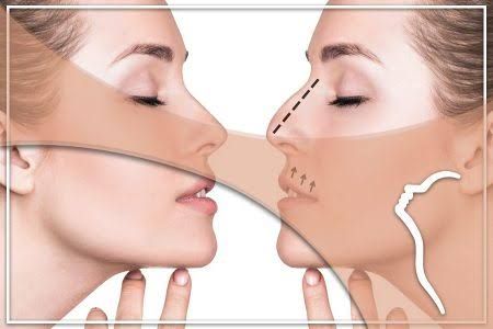 Burun estetiği ameliyatının sağlığımıza 10 temel faydası