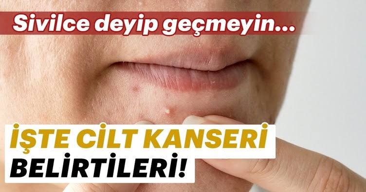 Leke sandığınız şey kanser olabilir!
