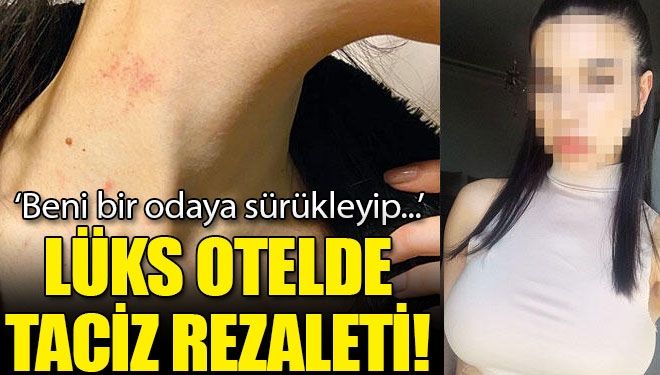 Lüks otelde taciz rezaleti!