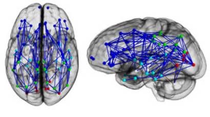 Kadın beyni erkek beynine göre daha genç
