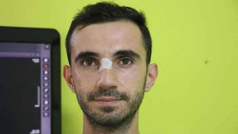 Şah kartalı, pençe darbesiyle veterineri yaraladı Şah kartalı, pençe darbesiyle veterineri yaraladı