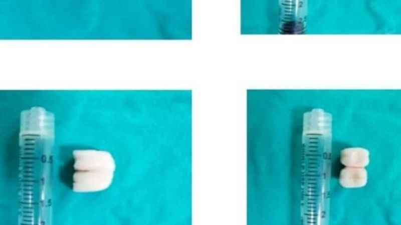 Diş tedavisi için gitti canından oluyordu Diş tedavisi için gitti canından oluyordu