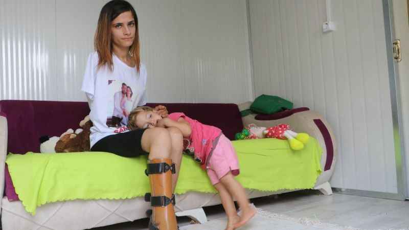 Depremde kolunu kaybeden anne, kızıyla olan hayallerini gerçekleştirebilmek için biyonik kola kavuşmak istiyor Depremde kolunu kaybeden anne, kızıyla olan hayallerini gerçekleştirebilmek için biyonik kola kavuşmak istiyor