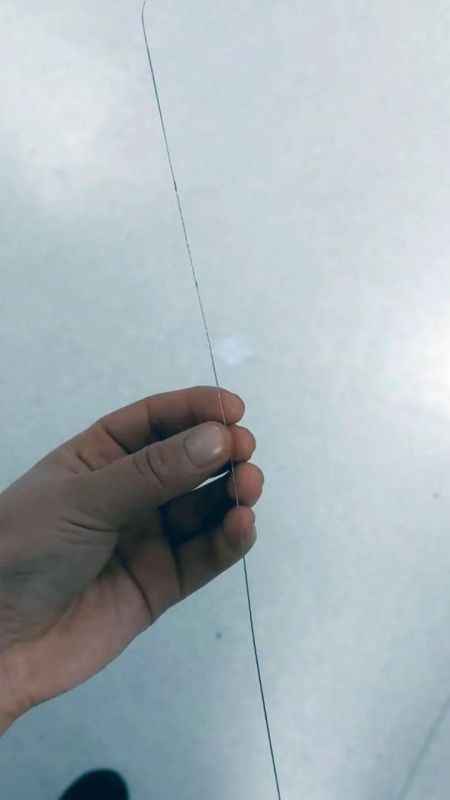 Ayak topuğundan çıkan tel şaşırttı!