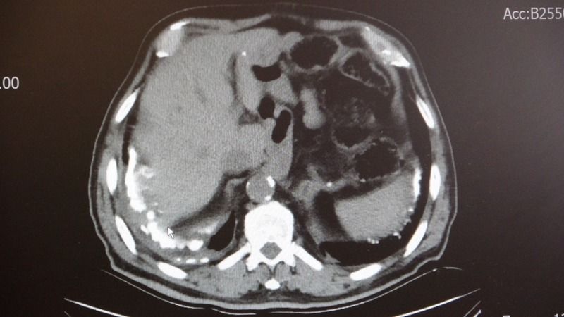 Deprem Bölgesinde ‘Asbest ve Silisyum’ Uyarısı