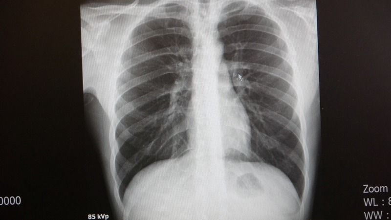 Deprem Bölgesinde ‘Asbest ve Silisyum’ Uyarısı Deprem Bölgesinde ‘Asbest ve Silisyum’ Uyarısı