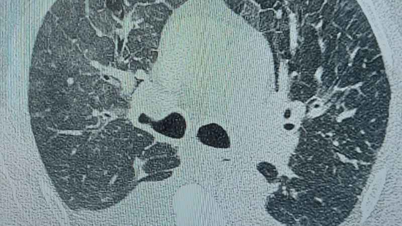 Su diyeti yapacağım diye hayatınızdan olmayın!