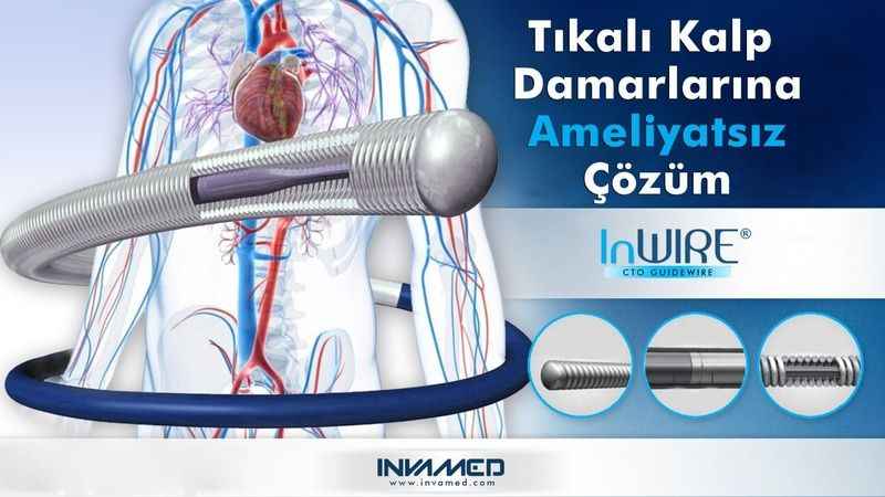 Kalp damarları tam tıkalı da olsa çözümü var Kalp damarları tam tıkalı da olsa çözümü var
