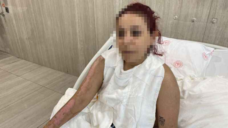Beyoğlu’nda barda yanmıştı, şimdi durumu iyi Beyoğlu’nda barda yanmıştı, şimdi durumu iyi