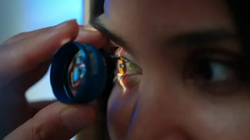 Göz kaşıma alışkanlığına dikkat edin! Göz tabakanız incelebilir