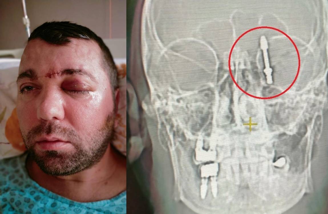 İmplant yaptırmak istedi, ölümden döndü