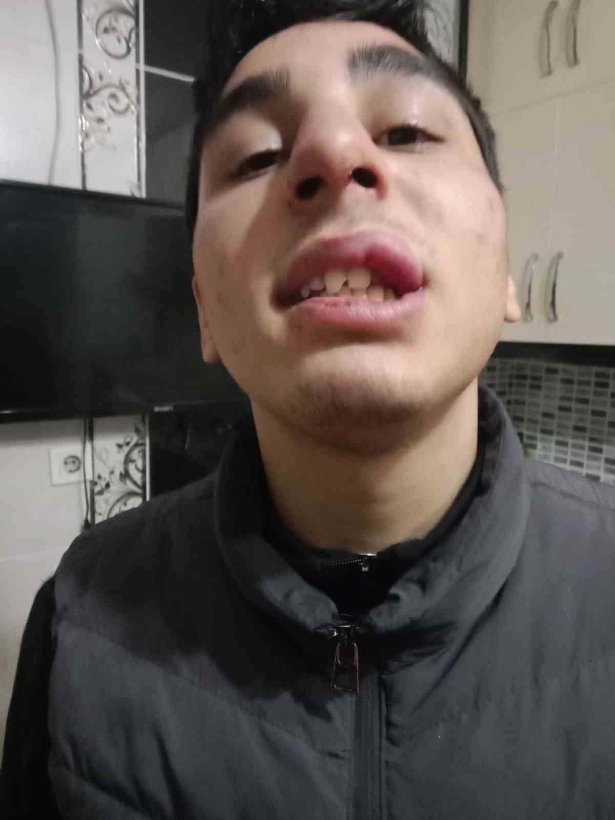 16 yaşındaki çocuk gündüz tartıştığı arkadaşının babası tarafından akşam darp edildi
