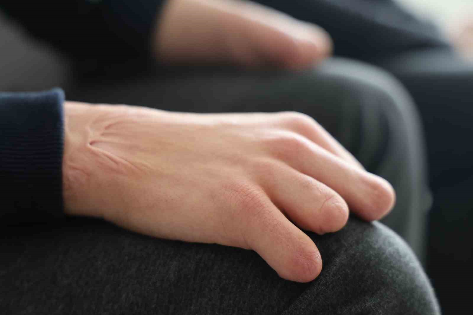 18 günlükken uzuvlarını kaybeden genç azmiyle örnek oluyor

