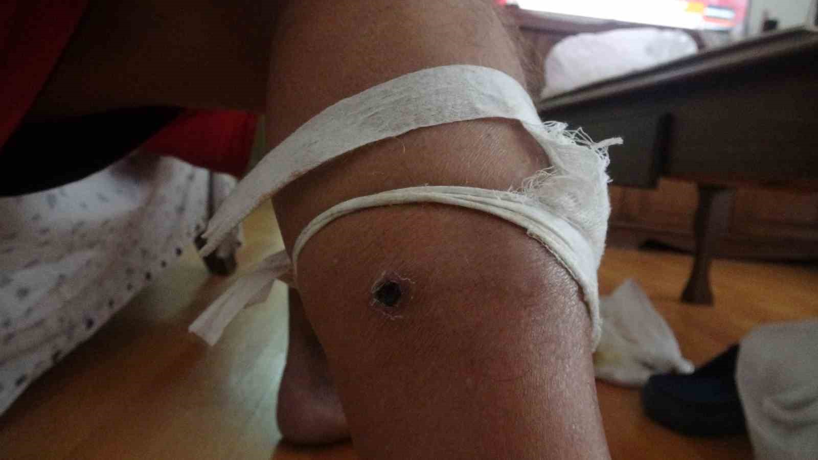 2021 yılından bu yana öz ağabeyi ve yeğeni tarafından 3 kez silahlı saldırıya uğradı
2021 yılından bu yana öz ağabeyi ve yeğeni tarafından 3 kez silahlı saldırıya uğradı