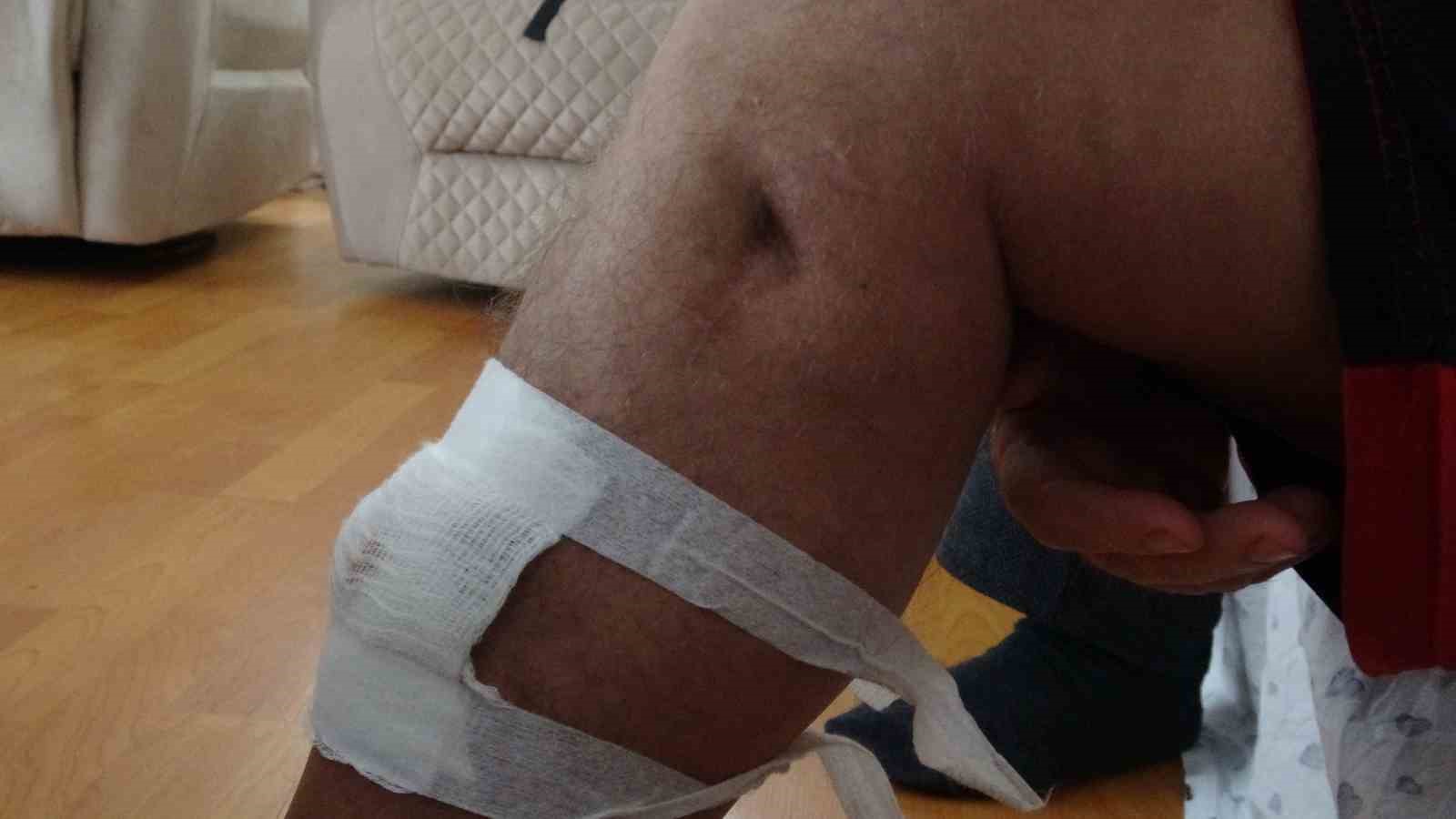 2021 yılından bu yana öz ağabeyi ve yeğeni tarafından 3 kez silahlı saldırıya uğradı
2021 yılından bu yana öz ağabeyi ve yeğeni tarafından 3 kez silahlı saldırıya uğradı