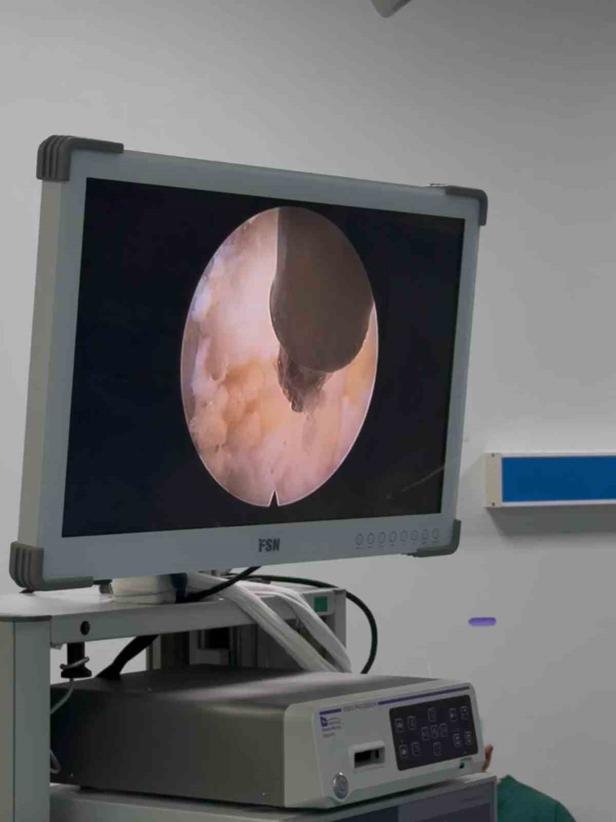 ADÜ Hastanesi’nde ilk kez uygulanmaya başladı
ADÜ Hastanesi’nde ilk kez uygulanmaya başladı