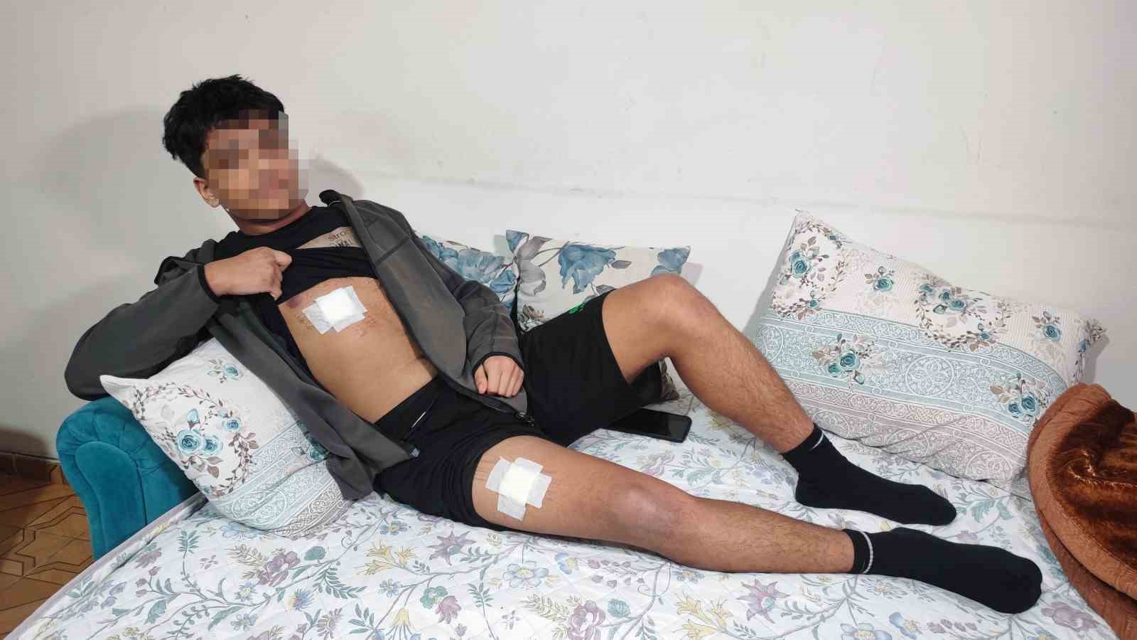 Akran zorbalığı az kalsın öldürüyordu: Önce dövüldü sonra bıçaklandı
