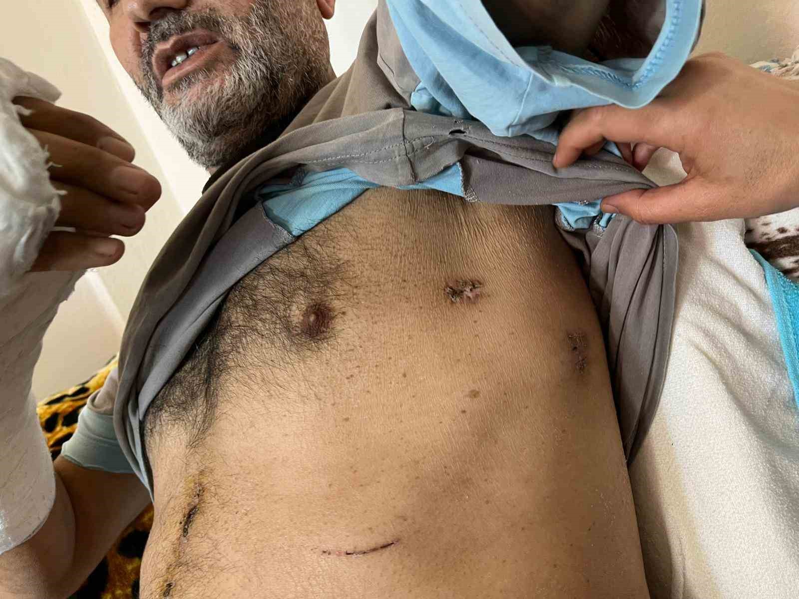 Almanya’dan cinayet için gelmiş: Ablasını öldürdü eniştesini ağır yaraladı
