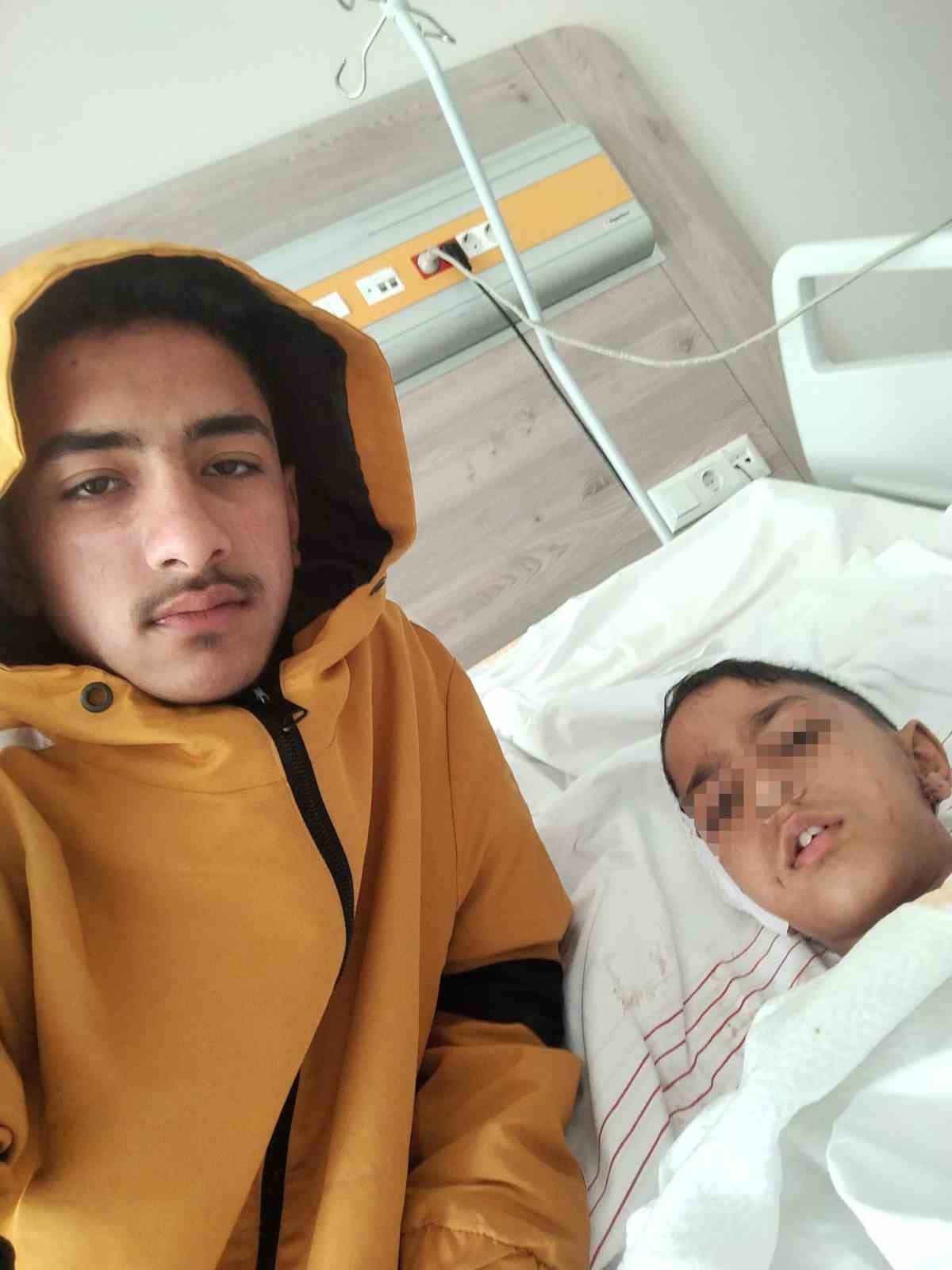 Ankara’da sokak köpeğinin saldırısına uğrayan çocuk yaralandı
