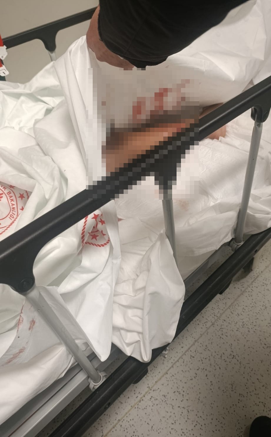 Ankara’da sokak köpeğinin saldırısına uğrayan çocuk yaralandı
