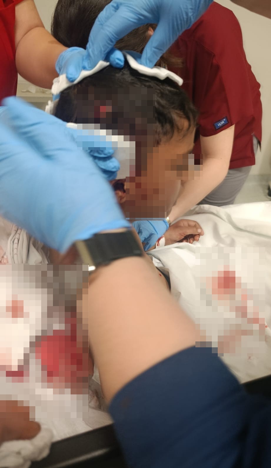 Ankara’da sokak köpeğinin saldırısına uğrayan çocuk yaralandı
