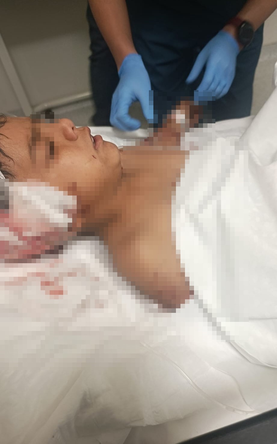 Ankara’da sokak köpeğinin saldırısına uğrayan çocuk yaralandı
