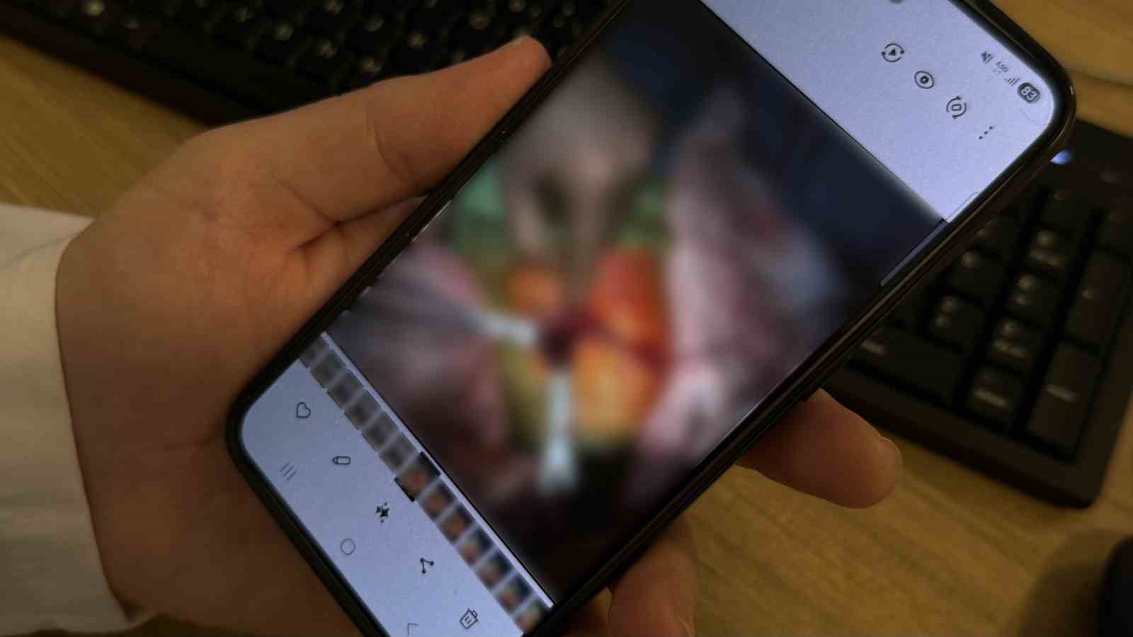 Anne karnındayken milyonda bir görülecek sağlık sorunuyla doğdu
