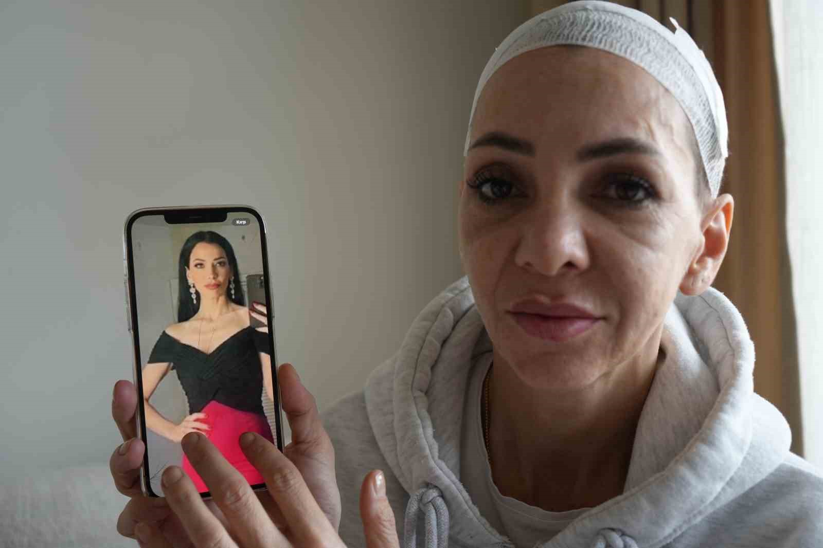 Anne ve oğlunu öldüresiye darp eden şüpheliler: "Merdivenlerden düştü"
