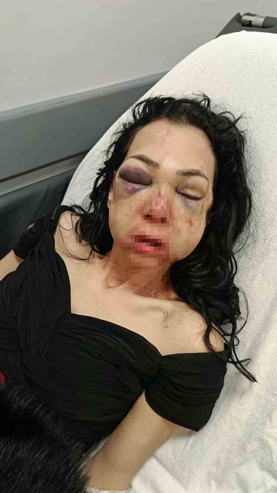 Anne ve oğlunu öldüresiye darp eden şüpheliler: "Merdivenlerden düştü"
