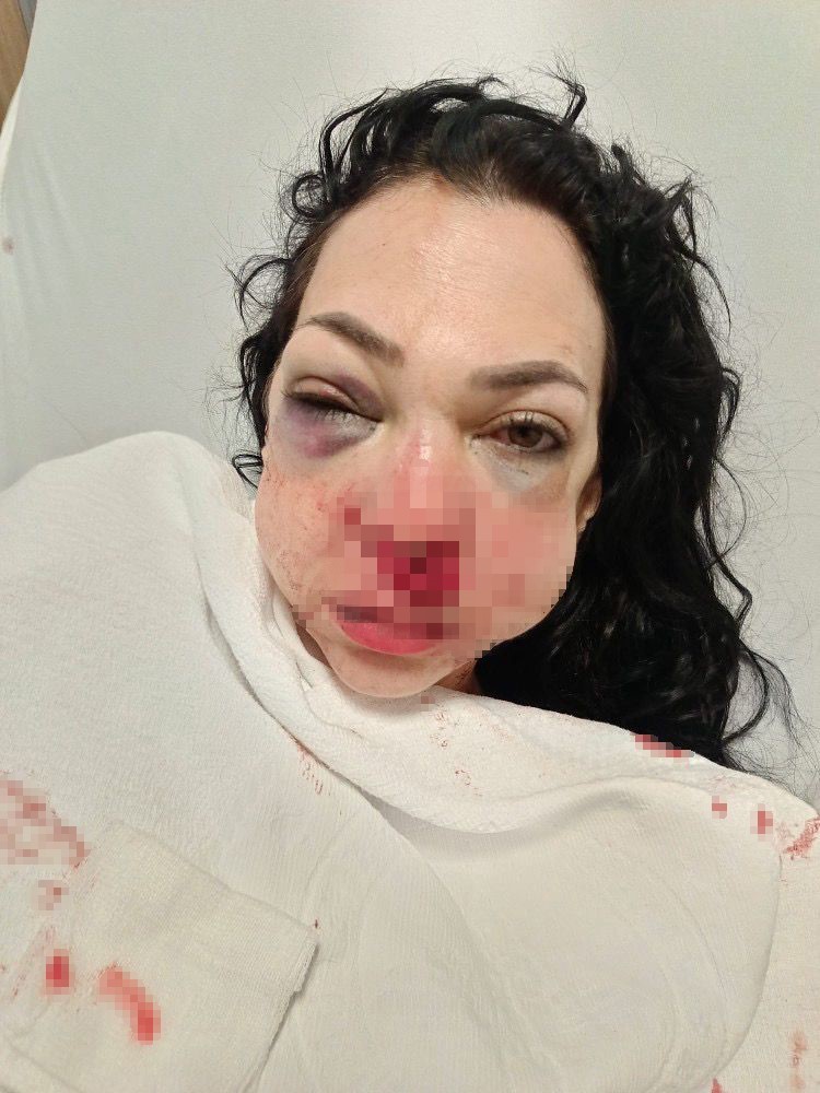 Anne ve oğlunun darp edilmesine ilişkin gözaltına alınan 3 şüpheliden 1’i tutuklandı
