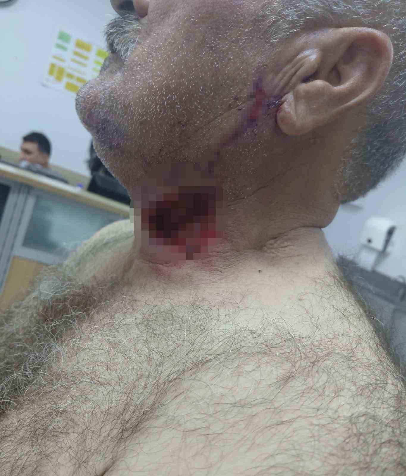 At sahibini boğazından ısırarak ağır yaraladı
