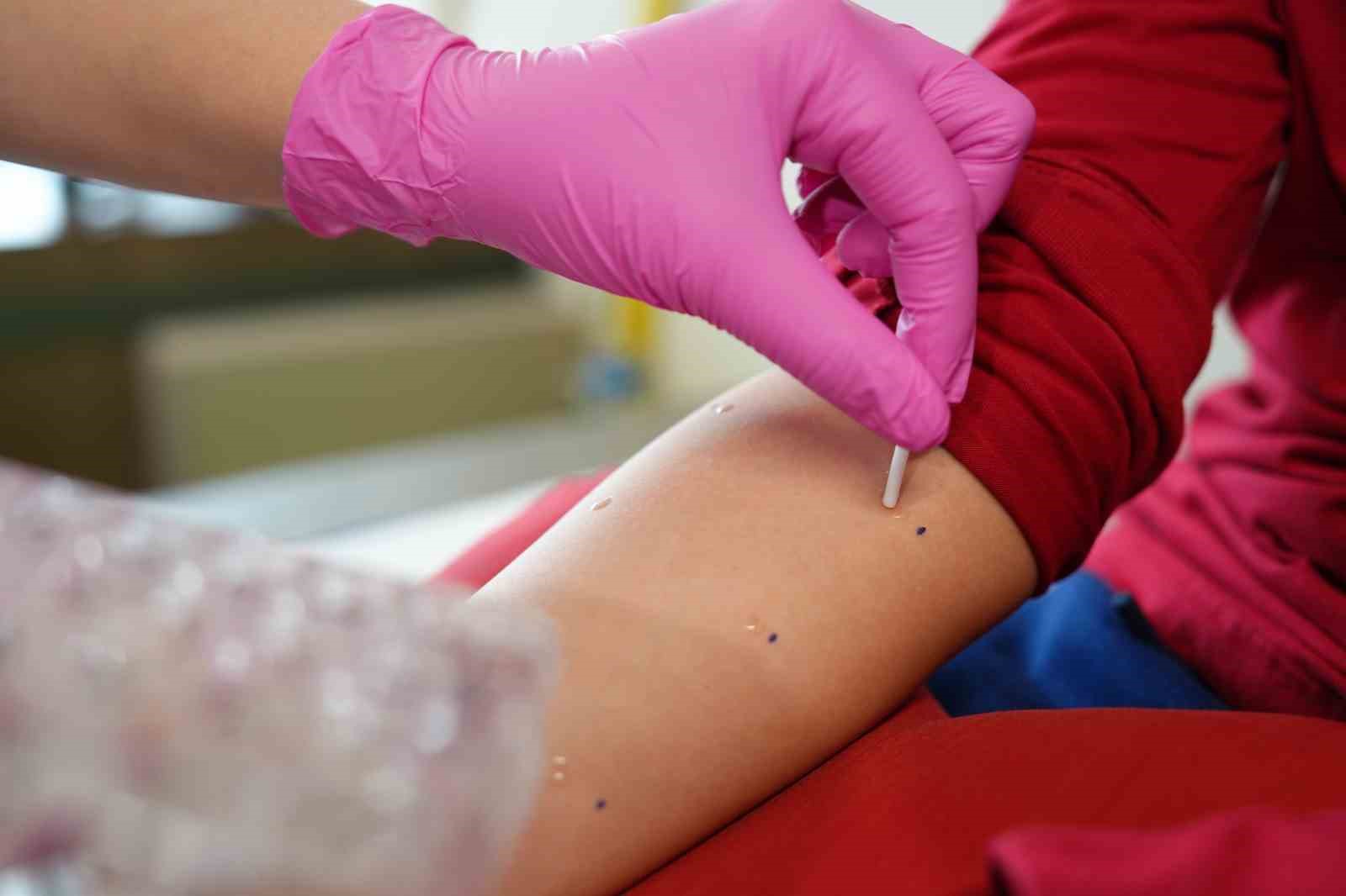 Baharla birlikte polen alerjisi alarmı
Baharla birlikte polen alerjisi alarmı