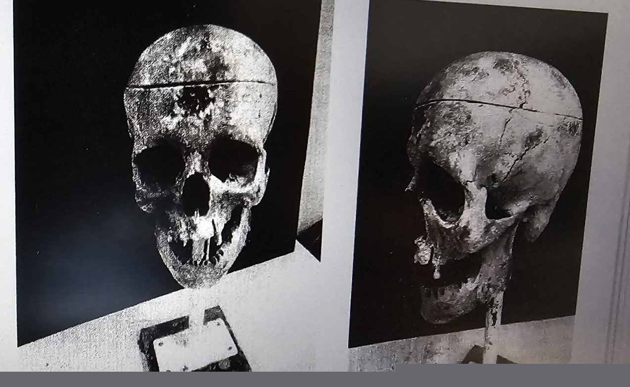 Barajdaki kemiklerle 18 yıllık cinayetin sırrı çözüldü
