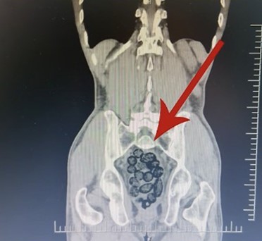 Batman’da yabancı uyruklu bir  şahsın midesinden 64 parça uyuşturucu çıktı
