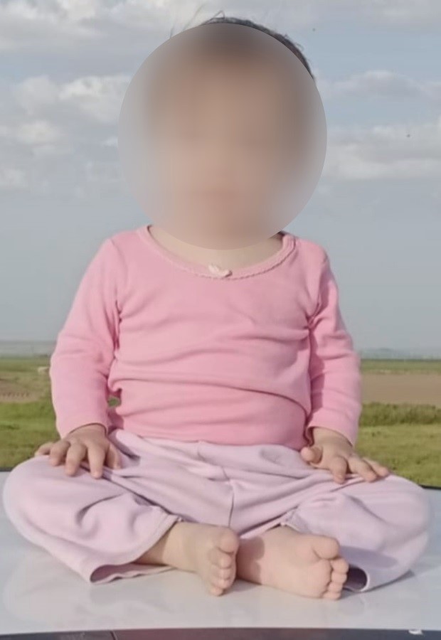 Bebeğin Down Sendromlu doğacağını bildirmedi, 81 milyon liralık cezaya çarptırıldı
