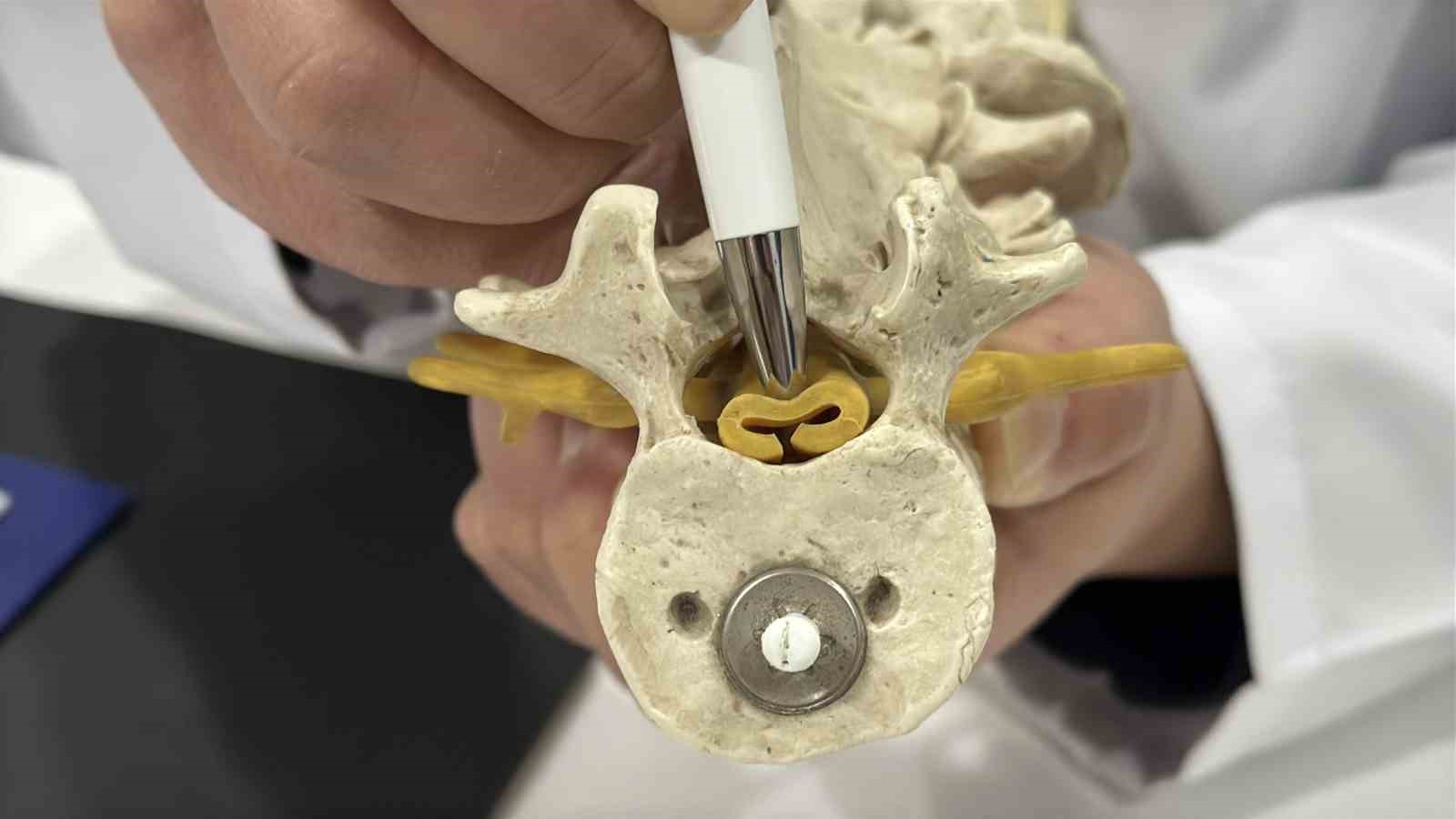 Beldeki gizli tehlike: Spinal stenoz
Beldeki gizli tehlike: Spinal stenoz