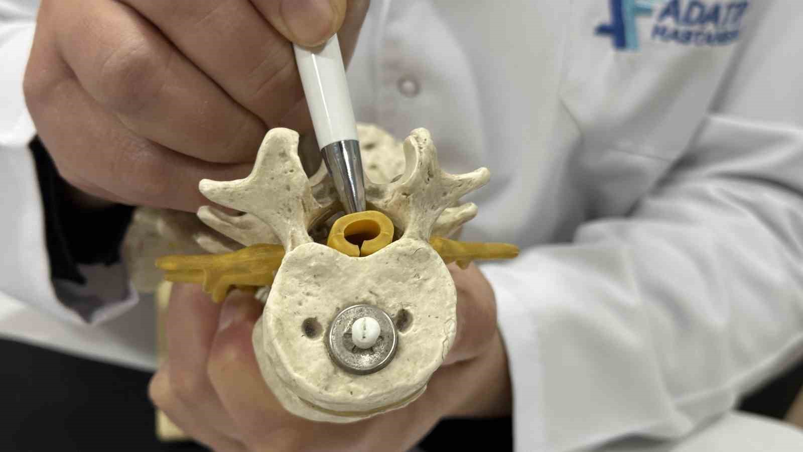 Beldeki gizli tehlike: Spinal stenoz
Beldeki gizli tehlike: Spinal stenoz