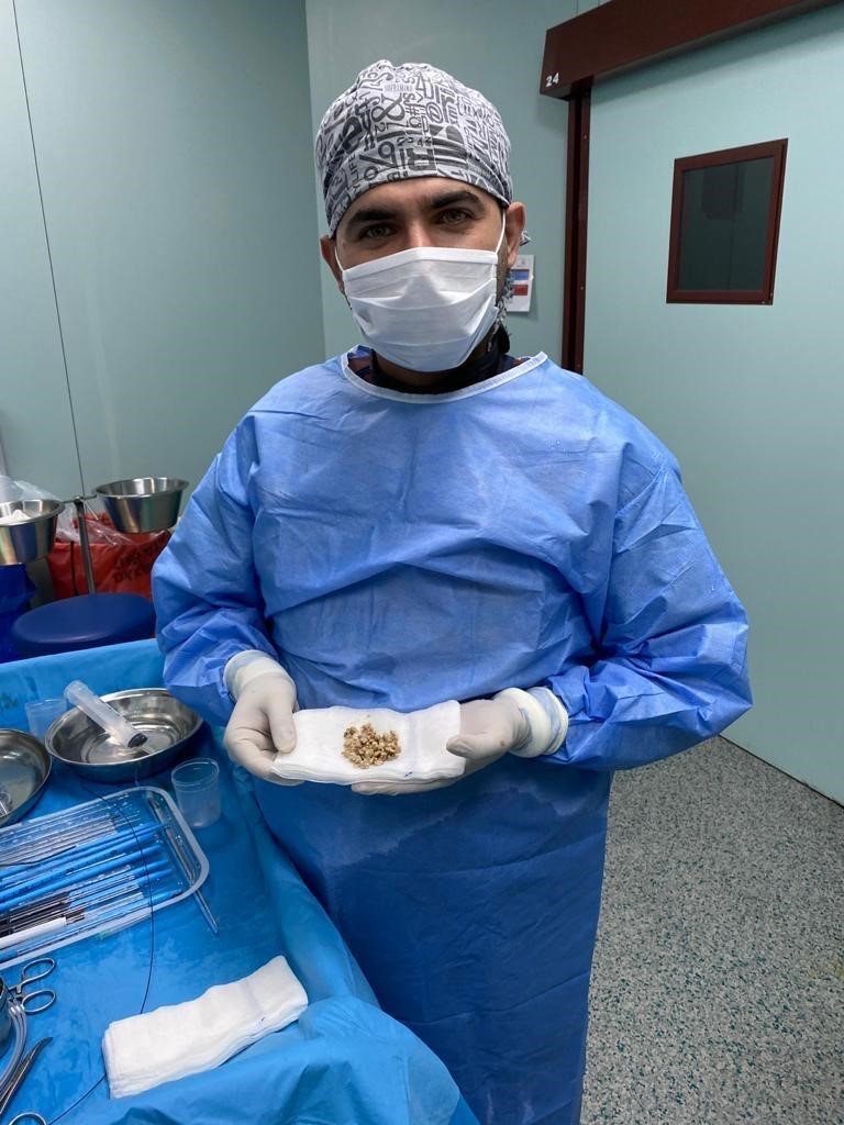 Bingöl’de PNL yöntemiyle böbrek taşı tedavisinde sevkler azaldı
