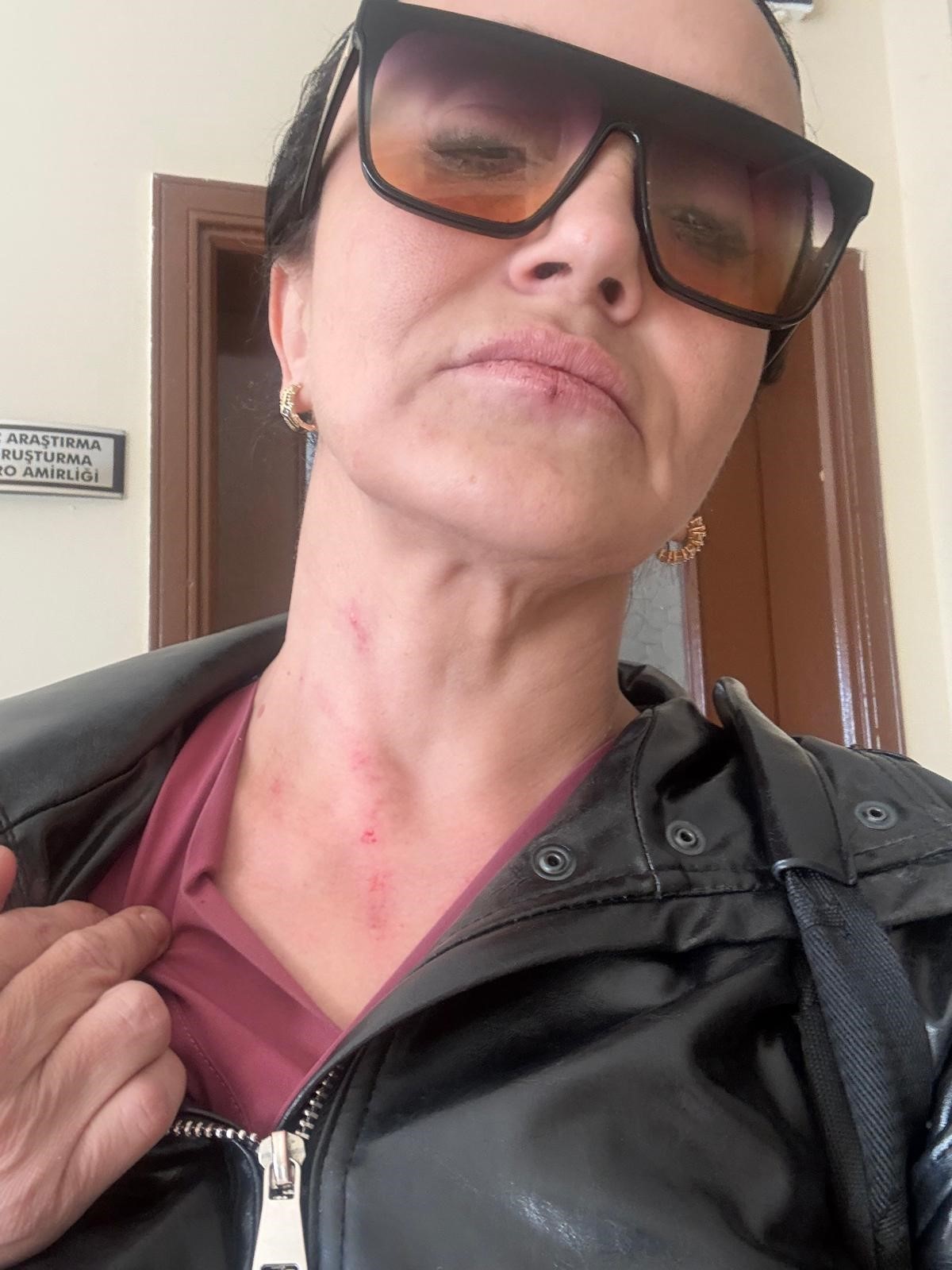 Boşanmaya çalıştığı eşi, yapmadığını bırakmadı
