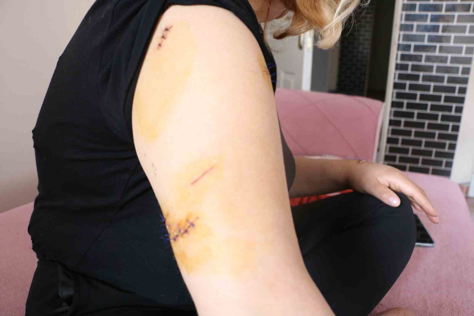 Diyarbakır’da dehşet: Nikahlı eşini 30 yerinden bıçakladı
