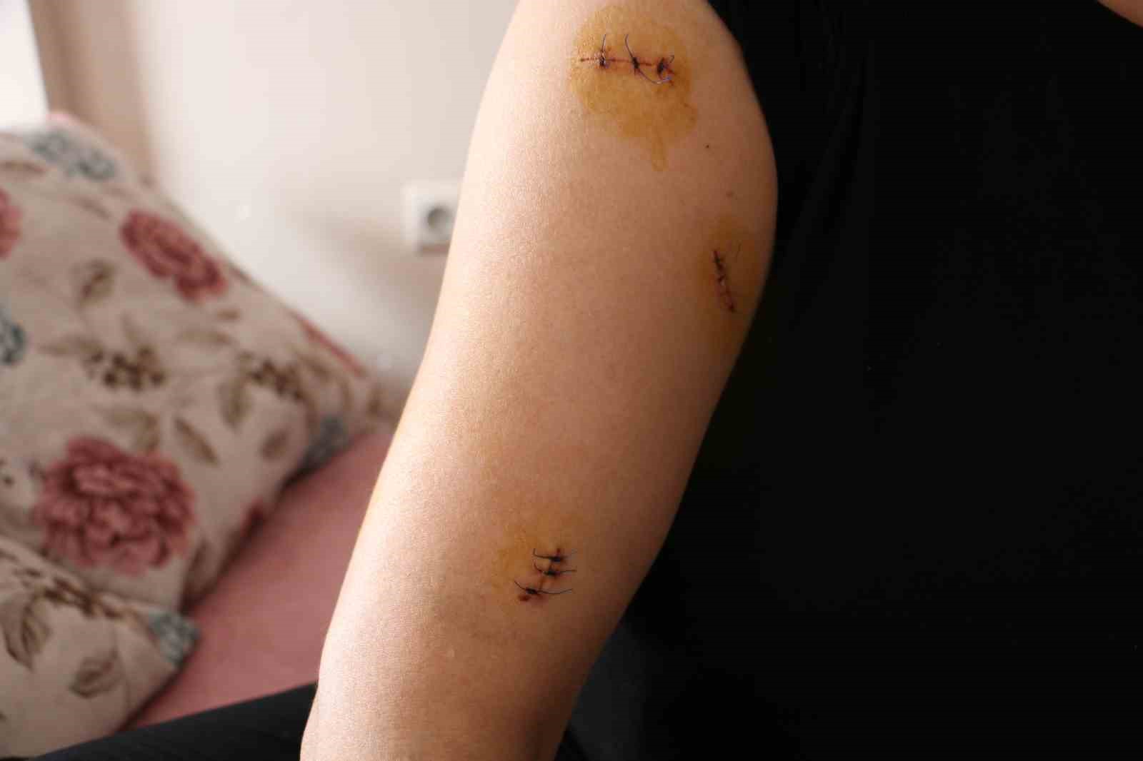 Diyarbakır’da dehşet: Nikahlı eşini 30 yerinden bıçakladı
