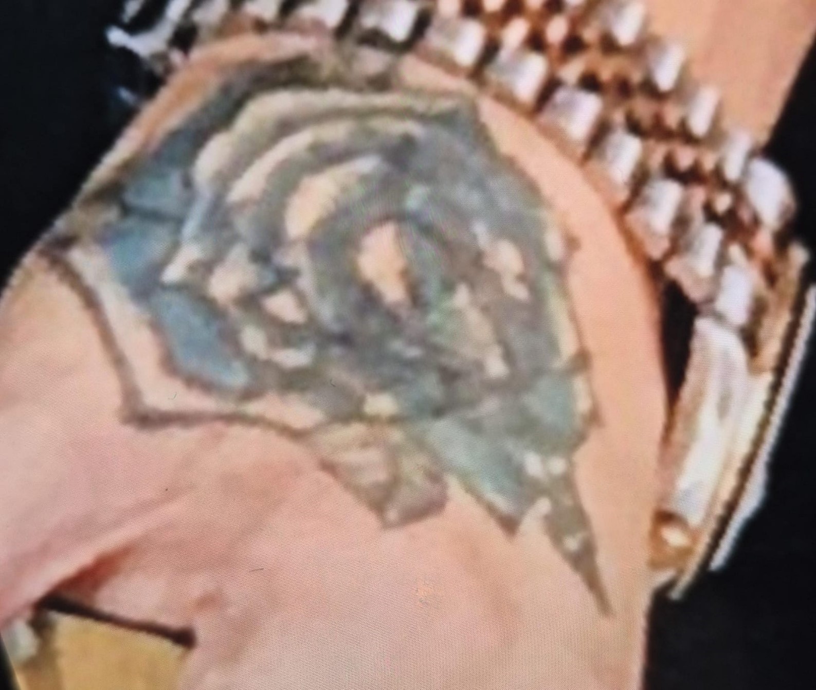 Dövme sildirmek isterken kabusu yaşadı, elindeki dokular öldü
Dövme sildirmek isterken kabusu yaşadı, elindeki dokular öldü