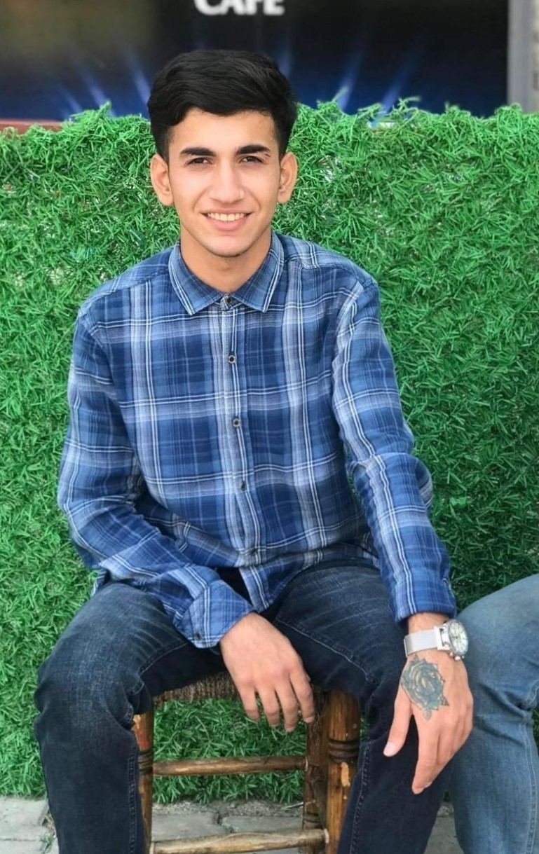 Dövme sildirmek isterken kabusu yaşadı, elindeki dokular öldü
Dövme sildirmek isterken kabusu yaşadı, elindeki dokular öldü