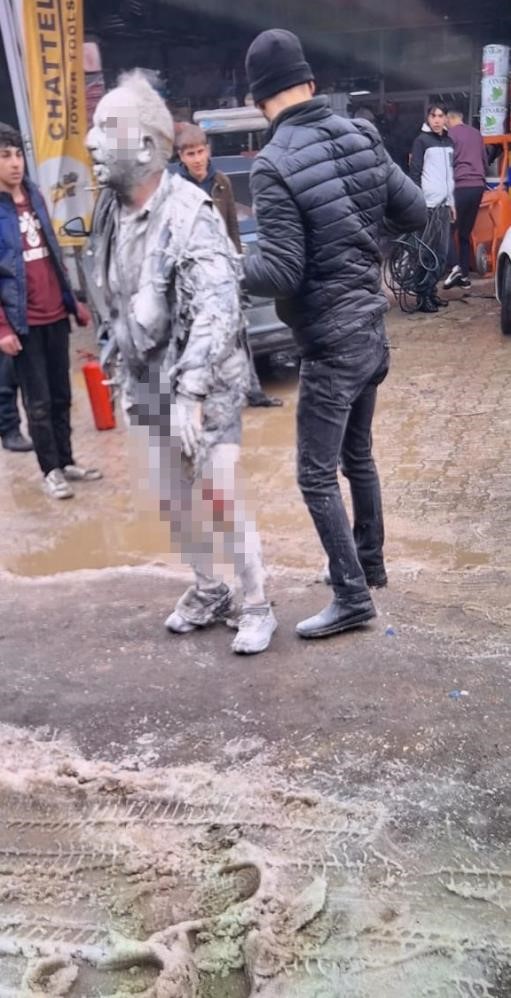 Ergani’deki patlamada ağır yaralanan şahıs hayatını kaybetti
