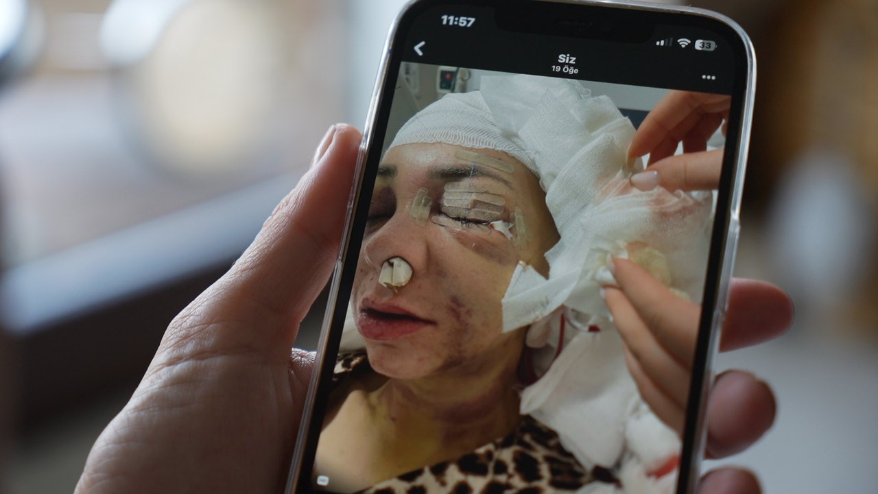 Feci şekilde darp edilmişti, yaşadığı dehşeti unutamıyor
