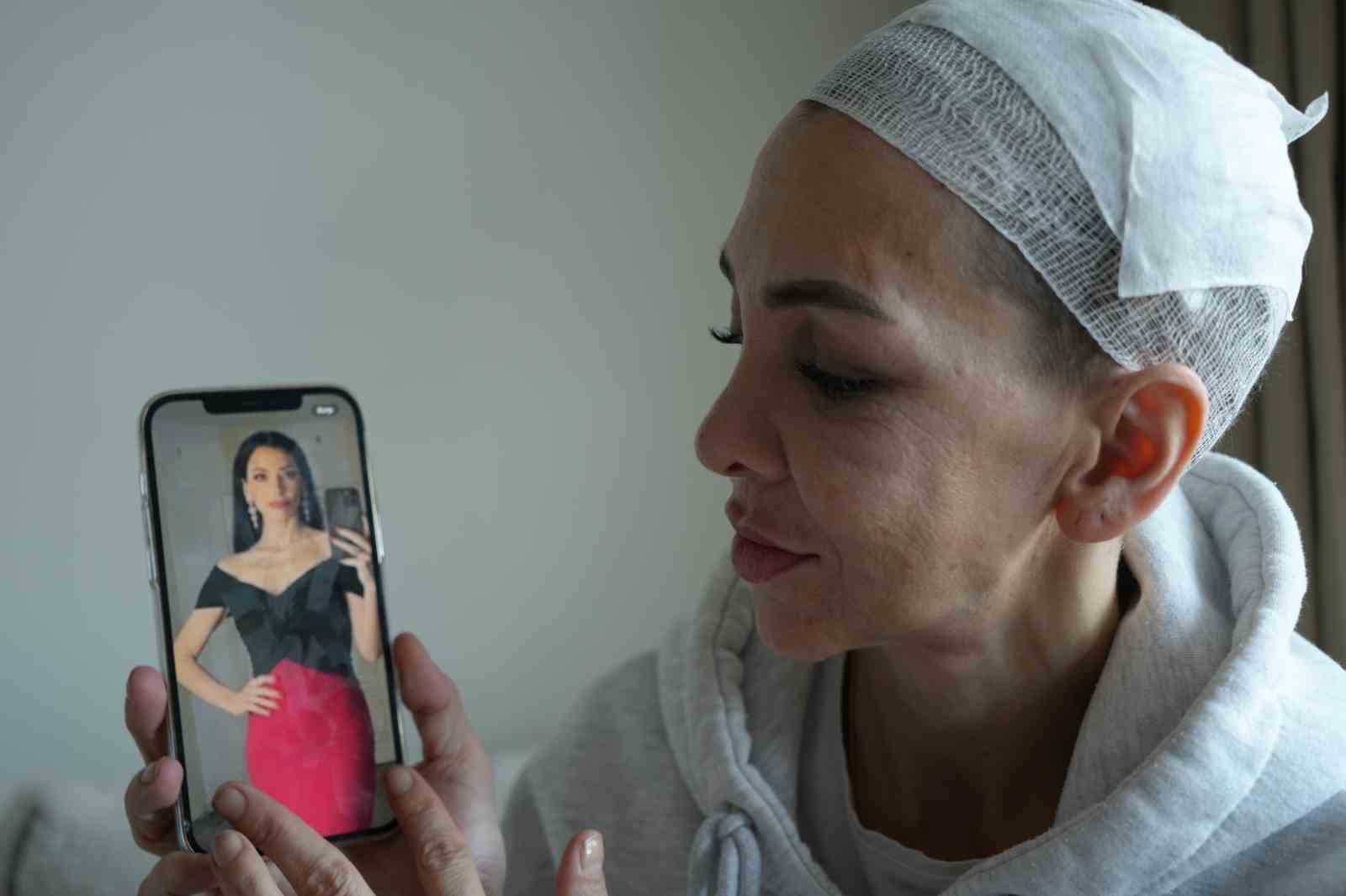 Feci şekilde darp edilmişti, yaşadığı dehşeti unutamıyor
