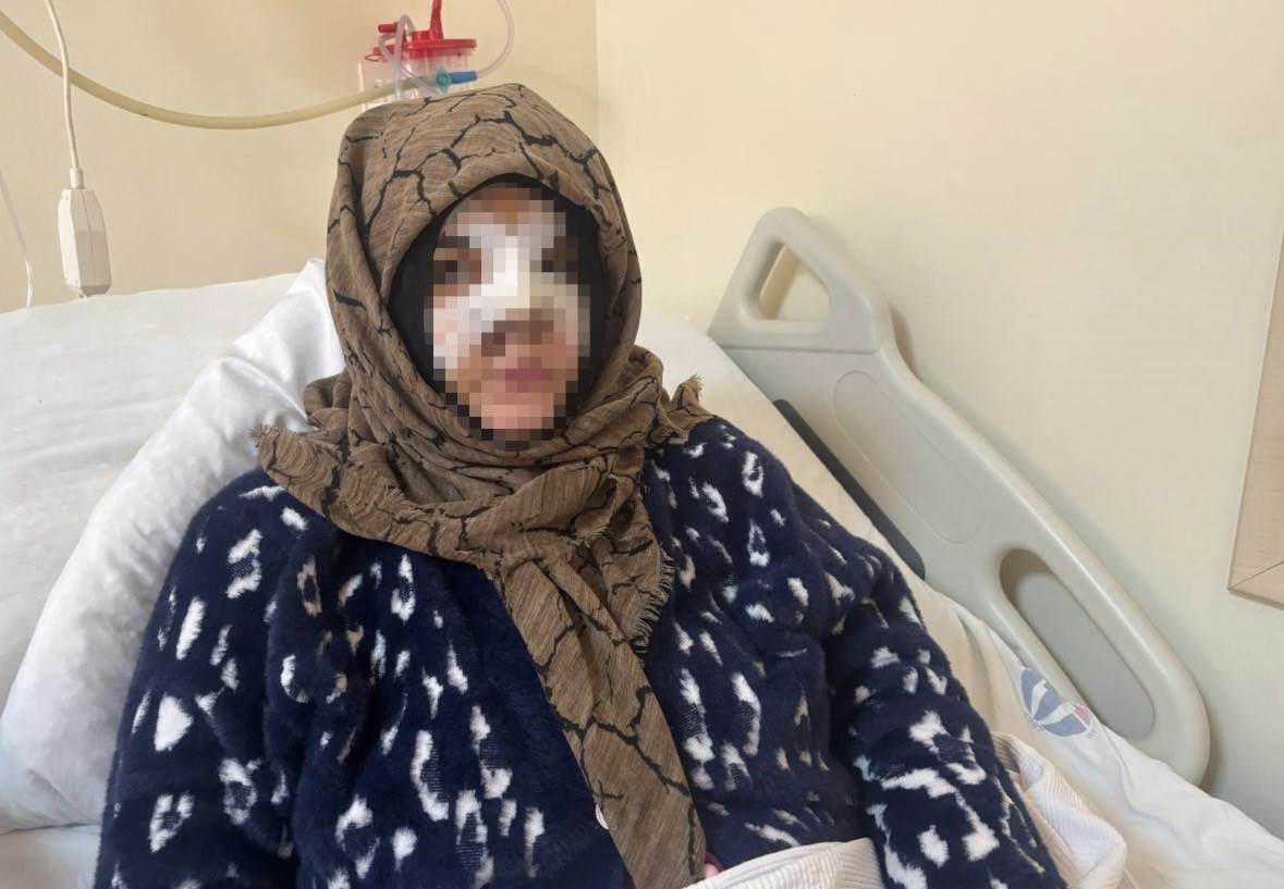 Gaziantep’te eşinin yüzünü taşla ezip darbeden sanık ağır cezada yargılanacak
