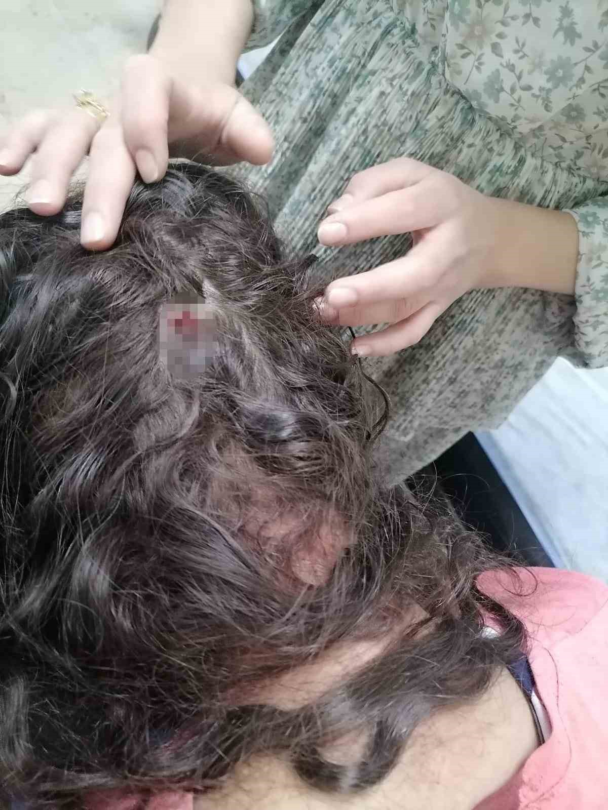 Gaziantep’te iki kız çocuğunu öldüresiye döven sanıklara 15 yıla kadar hapis talebi
