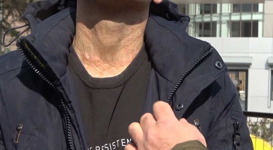 Gaziosmanpaşa’da duyma ve konuşma engeli bulunan kişinin telefonunu gasp eden ve benzin dökerek yakan sanık hakim karşısında
