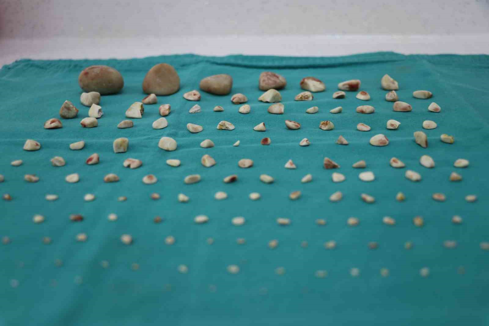 Görenler gözlerine inanamadı: Köpeğin karnından 140 taş çıktı
